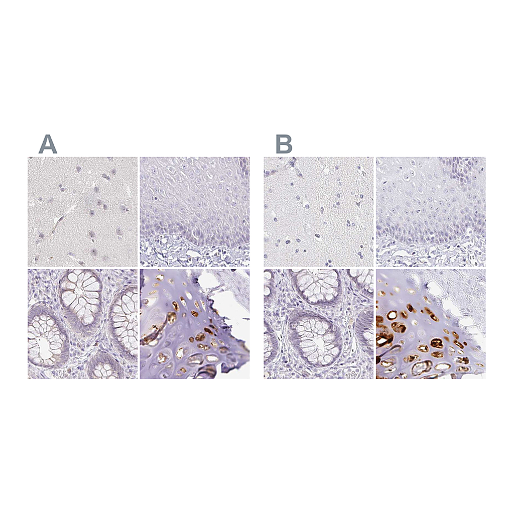 Atlas Antibodies Anti-ACAN Antibody