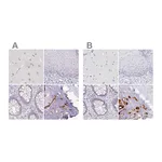 Atlas Antibodies Anti-ACAN Antibody