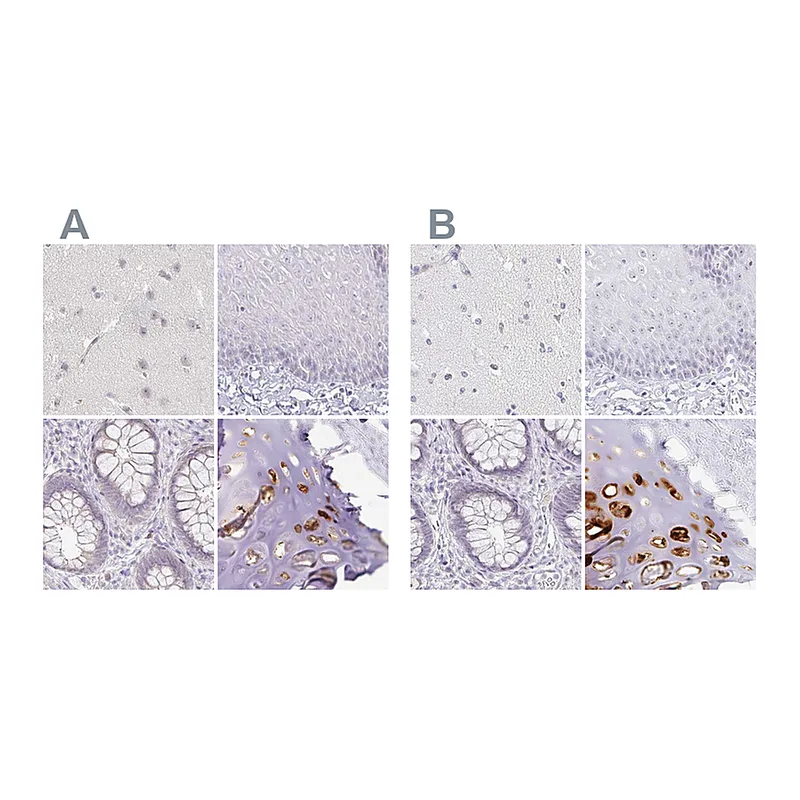 Atlas Antibodies Anti-ACAN Antibody