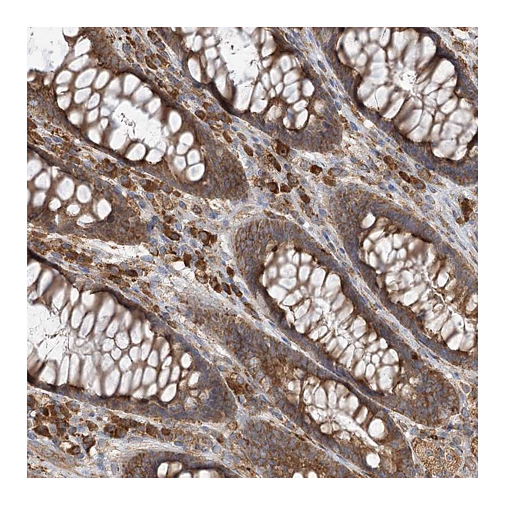 Atlas Antibodies Anti-ACAP2 Antibody
