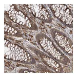 Atlas Antibodies Anti-ACAP2 Antibody