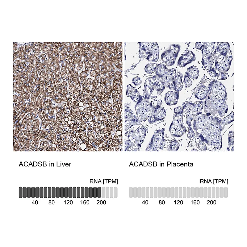 Atlas Antibodies Anti-ACADSB Antibody