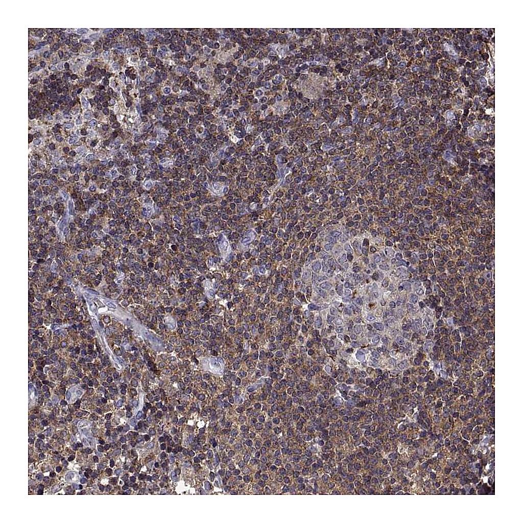 Atlas Antibodies Anti-ACAP1 Antibody