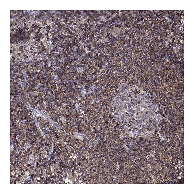 Atlas Antibodies Anti-ACAP1 Antibody