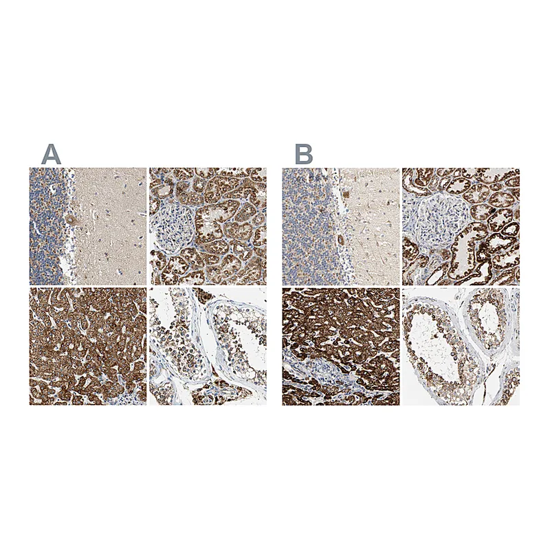 Atlas Antibodies Anti-ACAT1 Antibody