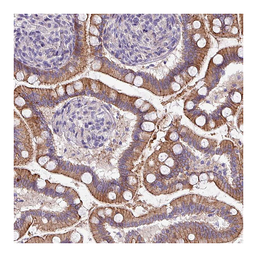 Atlas Antibodies Anti-ACAP3 Antibody