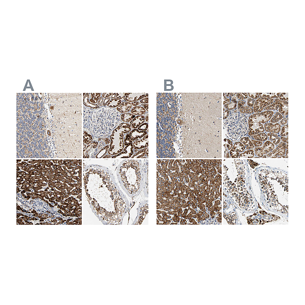 Atlas Antibodies Anti-ACAT1 Antibody