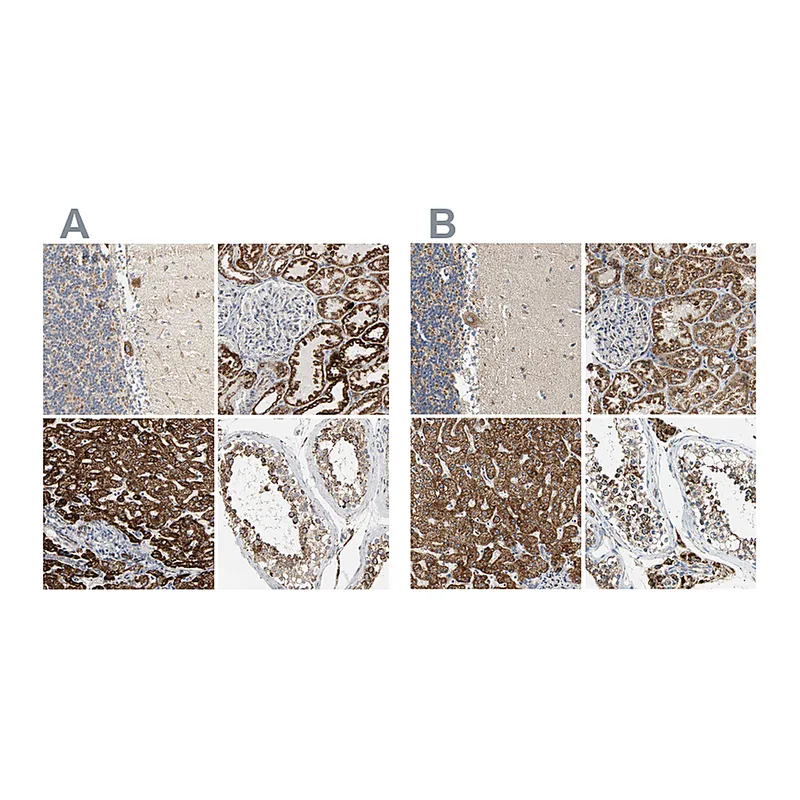 Atlas Antibodies Anti-ACAT1 Antibody