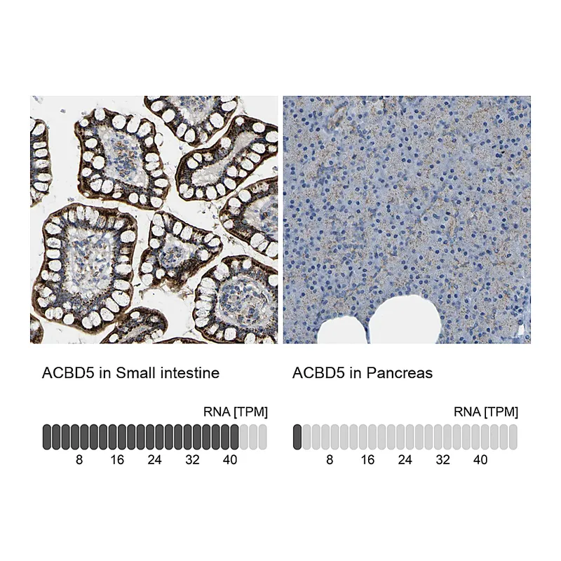 Atlas Antibodies Anti-ACBD5 Antibody
