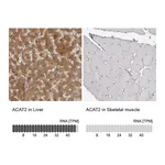 Atlas Antibodies Anti-ACAT2 Antibody