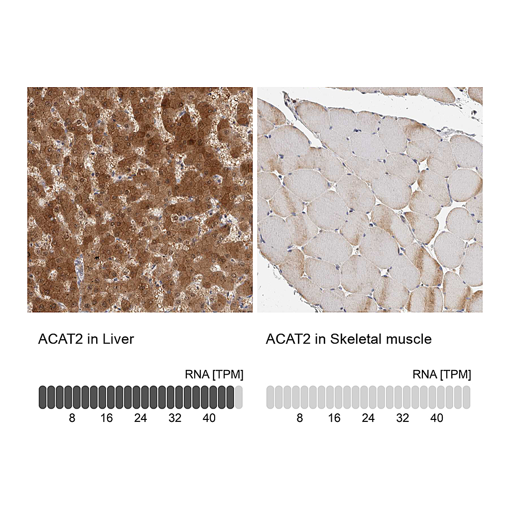 Atlas Antibodies Anti-ACAT2 Antibody