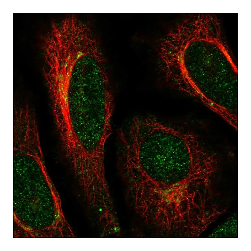 Atlas Antibodies Anti-ACAP3 Antibody