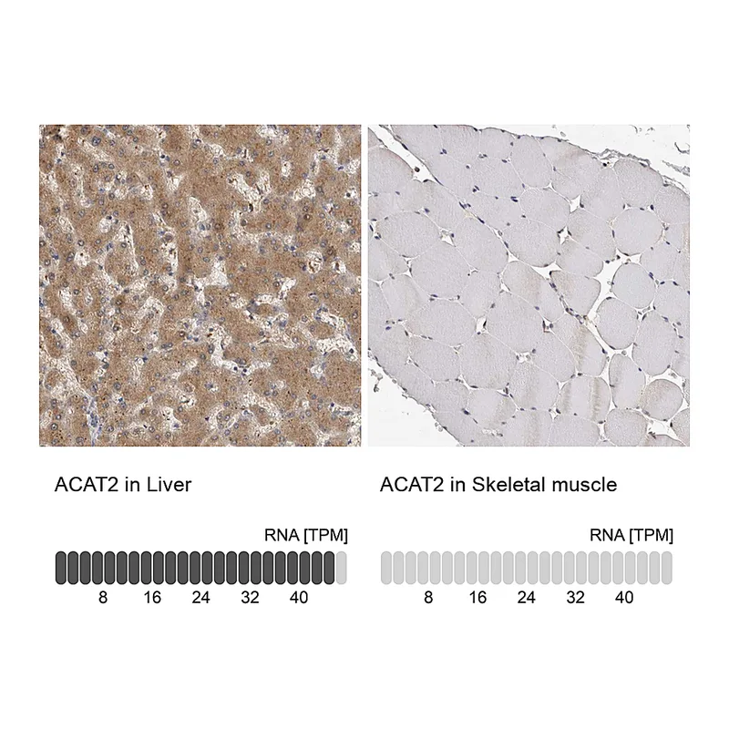 Atlas Antibodies Anti-ACAT2 Antibody