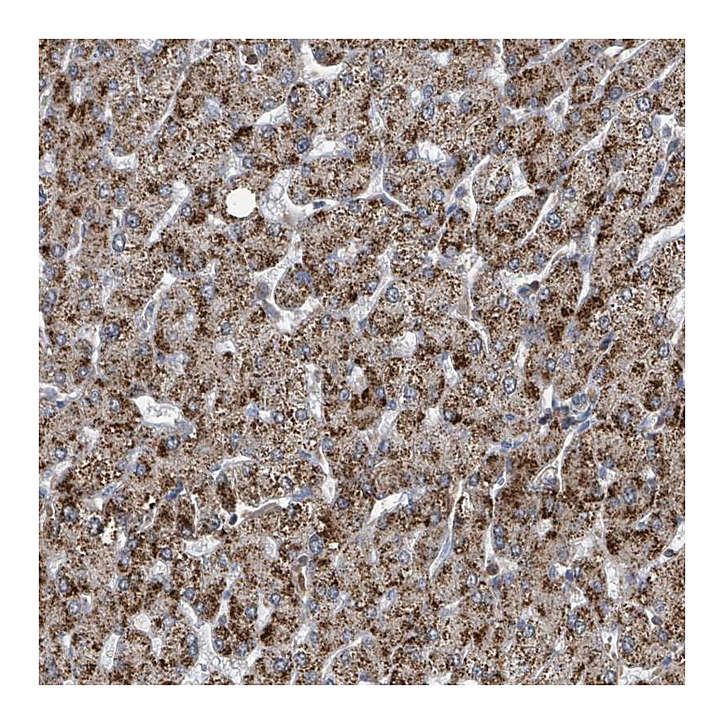 Atlas Antibodies Anti-ACBD4 Antibody