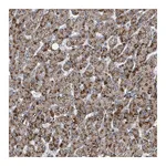 Atlas Antibodies Anti-ACBD4 Antibody