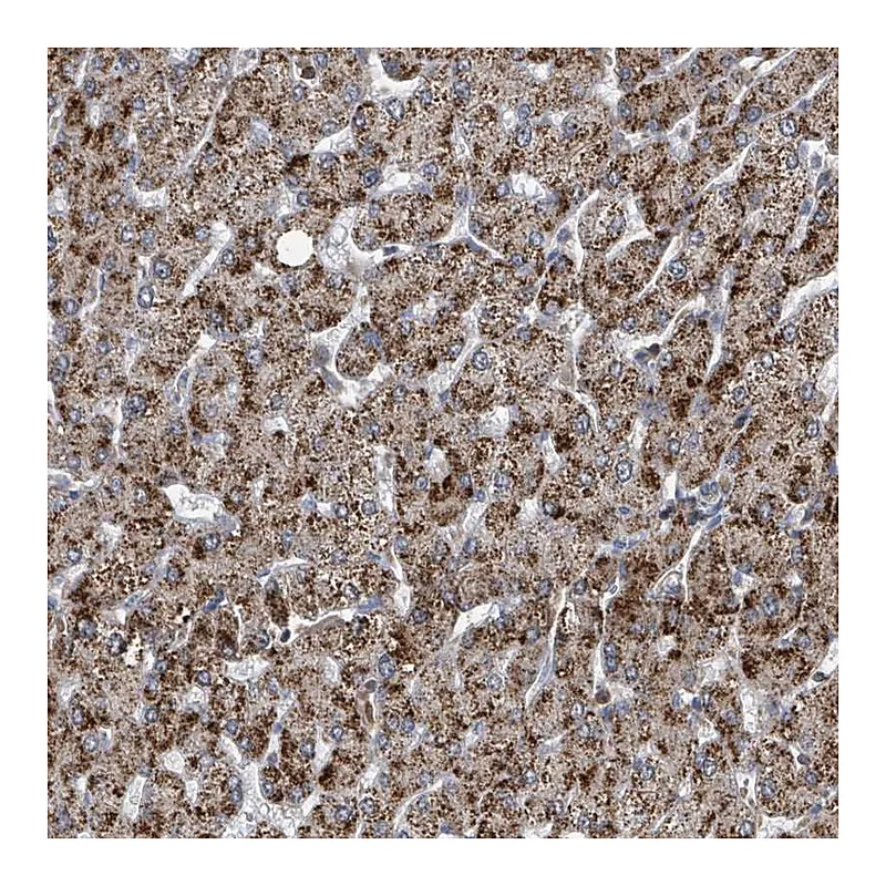 Atlas Antibodies Anti-ACBD4 Antibody