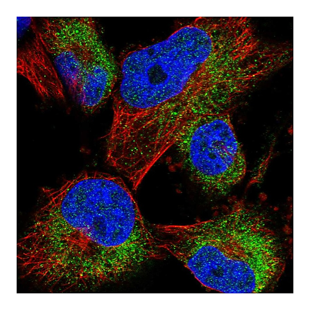 Atlas Antibodies Anti-ACBD7 Antibody