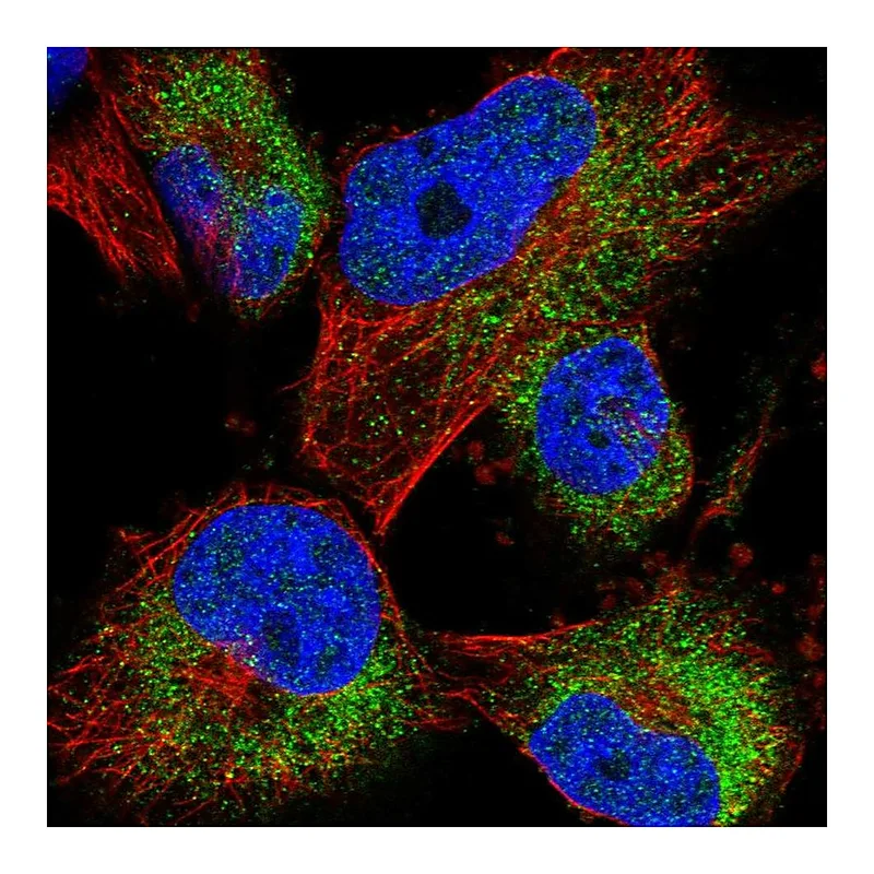 Atlas Antibodies Anti-ACBD7 Antibody