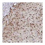 Atlas Antibodies Anti-ACD Antibody
