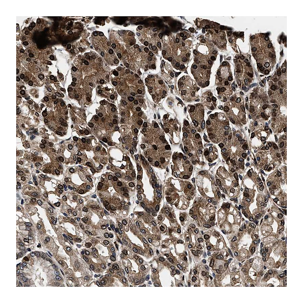 Atlas Antibodies Anti-ACCS Antibody