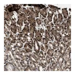 Atlas Antibodies Anti-ACCS Antibody