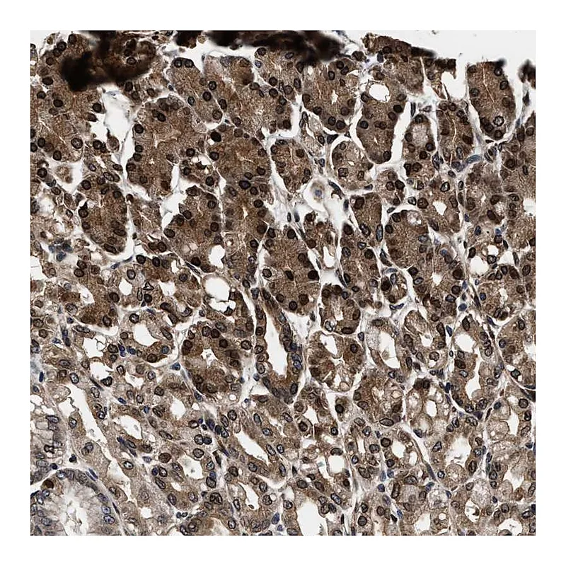 Atlas Antibodies Anti-ACCS Antibody