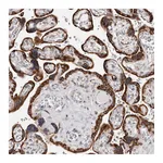Atlas Antibodies Anti-ACBD6 Antibody