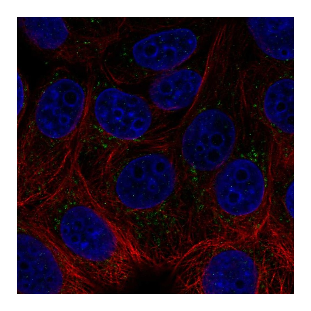 Atlas Antibodies Anti-ACHE Antibody