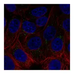 Atlas Antibodies Anti-ACHE Antibody