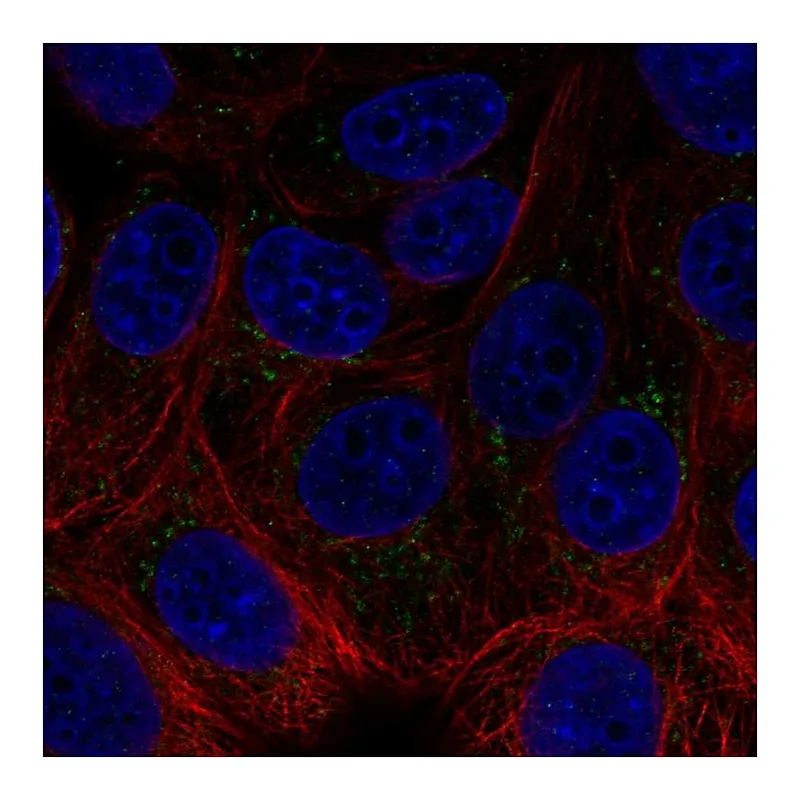 Atlas Antibodies Anti-ACHE Antibody