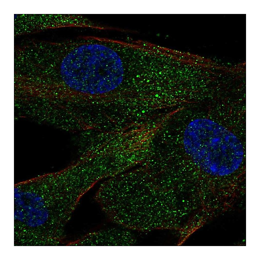 Atlas Antibodies Anti-ACE Antibody