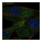 Atlas Antibodies Anti-ACE Antibody