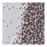 Atlas Antibodies Anti-ACIN1 Antibody