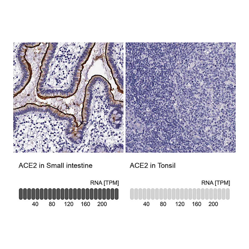 Atlas Antibodies Anti-ACE2 Antibody