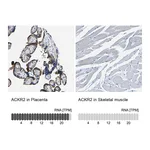 Atlas Antibodies Anti-ACKR2 Antibody