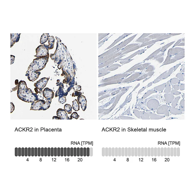 Atlas Antibodies Anti-ACKR2 Antibody