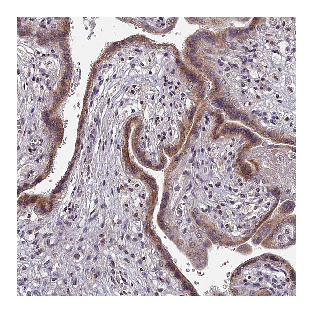 Atlas Antibodies Anti-ACKR3 Antibody