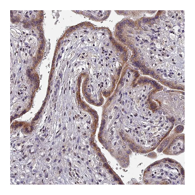 Atlas Antibodies Anti-ACKR3 Antibody