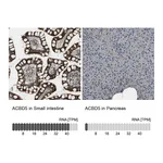 Atlas Antibodies Anti-ACBD5 Antibody