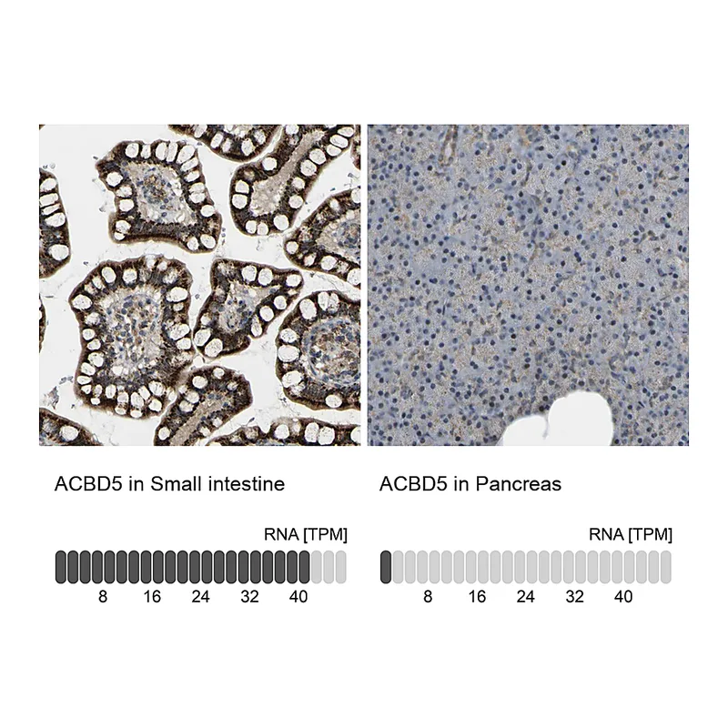 Atlas Antibodies Anti-ACBD5 Antibody