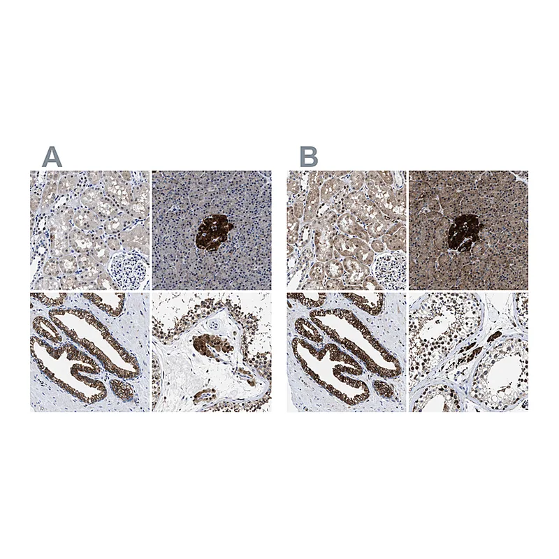 Atlas Antibodies Anti-ACLY Antibody