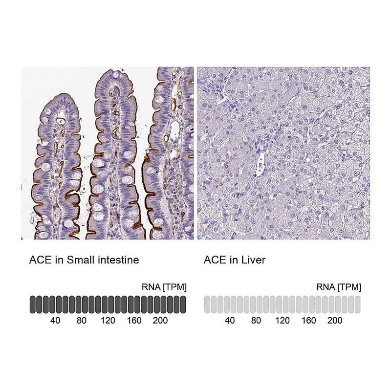 Atlas Antibodies Anti-ACE Antibody
