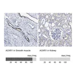 Atlas Antibodies Anti-ACKR1 Antibody