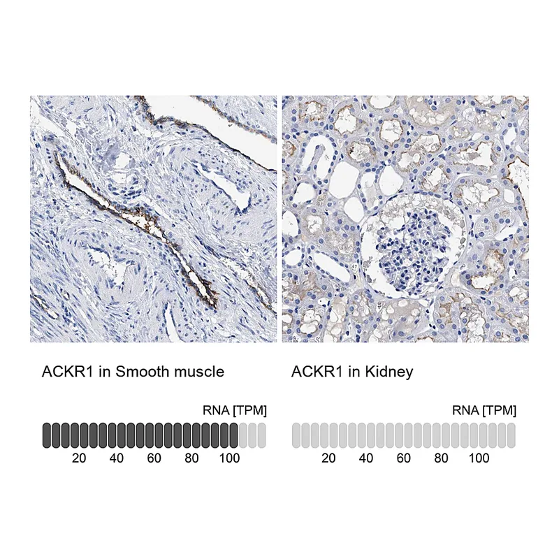 Atlas Antibodies Anti-ACKR1 Antibody