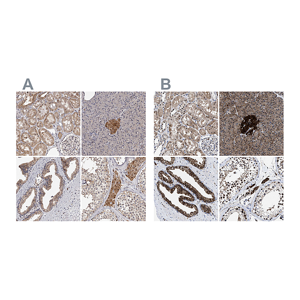 Atlas Antibodies Anti-ACLY Antibody