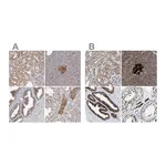 Atlas Antibodies Anti-ACLY Antibody