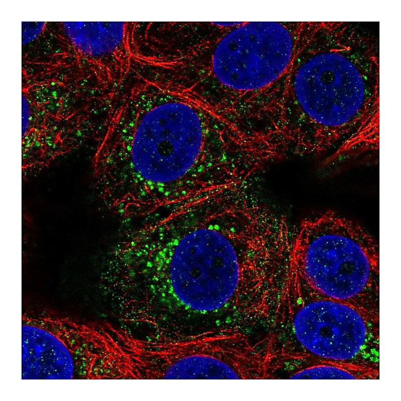 Atlas Antibodies Anti-ACBD7 Antibody
