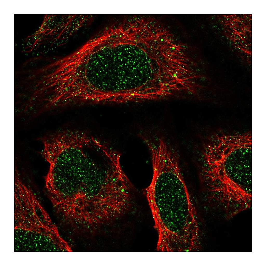 Atlas Antibodies Anti-ACKR2 Antibody