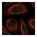 Atlas Antibodies Anti-ACKR2 Antibody