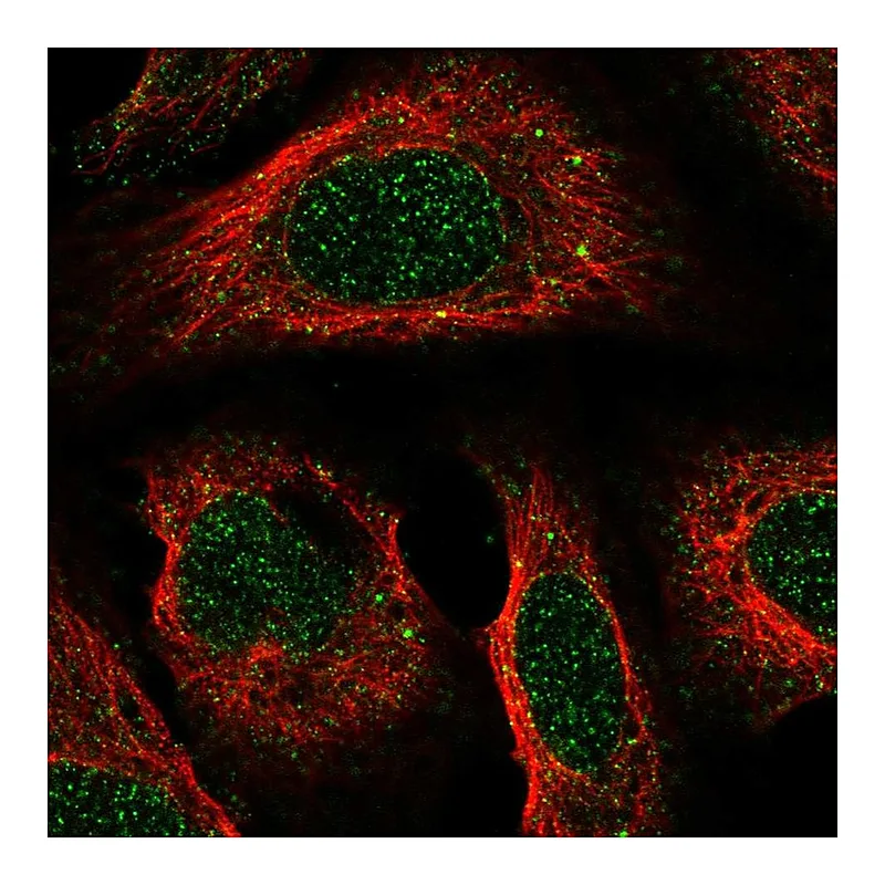 Atlas Antibodies Anti-ACKR2 Antibody